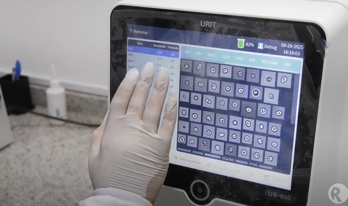 No momento, você está visualizando Aparelho com inteligência artificial promove agilidade nos resultados de exames